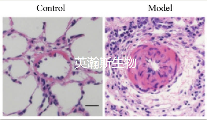 肺動(dòng)脈高血壓模型.jpg