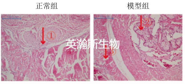 勃起功能障礙模型.png