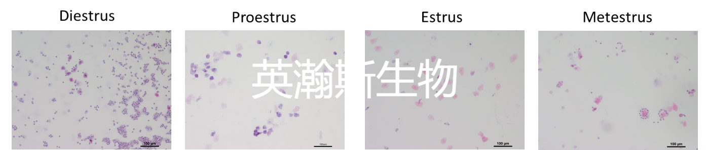 動(dòng)情周期.png